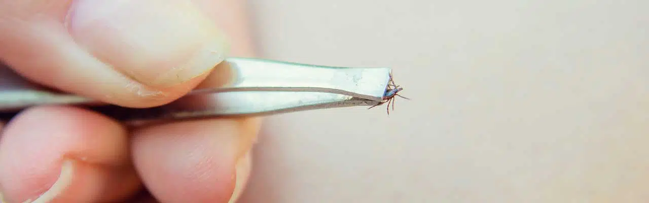 Photo of a person removing a tick from the body.